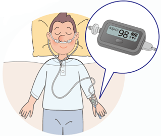 CPAP(Continuous Positive Airway Pressure)療法