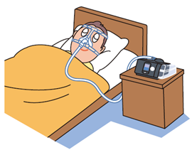 CPAP(Continuous Positive Airway Pressure)療法